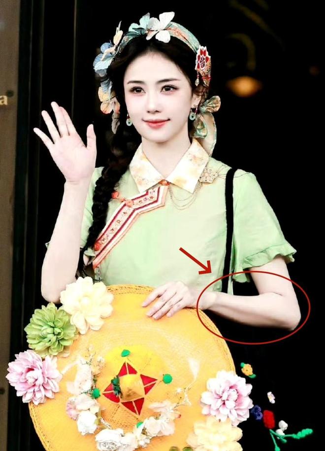 Người hâm mộ thấy lo thay khi nhìn vào khủy tay xương xẩu...