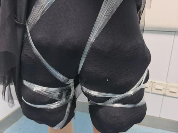 Phát hiện 58 con rùa sống buộc quanh hai chân một người phụ nữ ở cửa hải quan