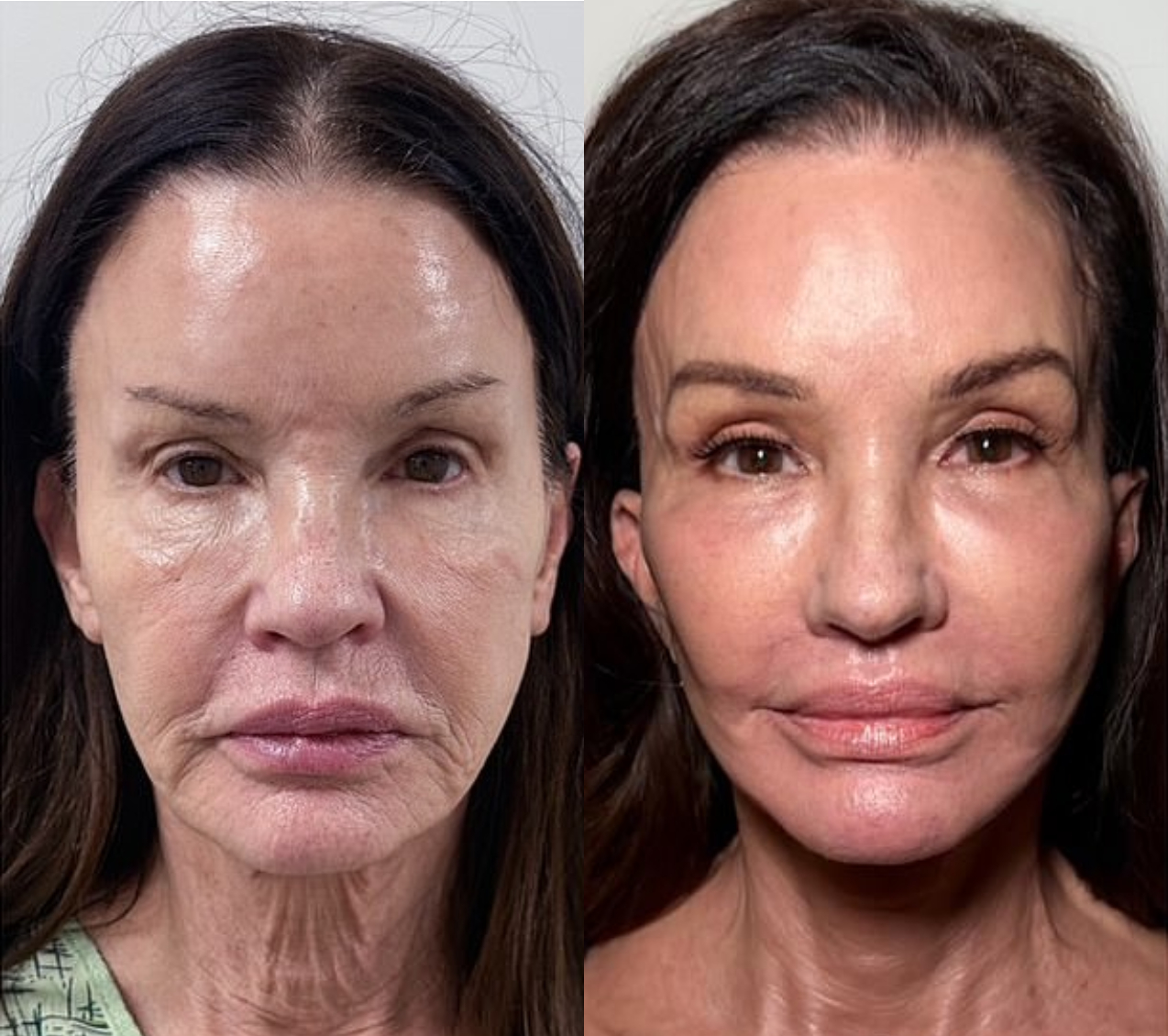 Từng tuyên bố mình là mẹ đẻ của từ 