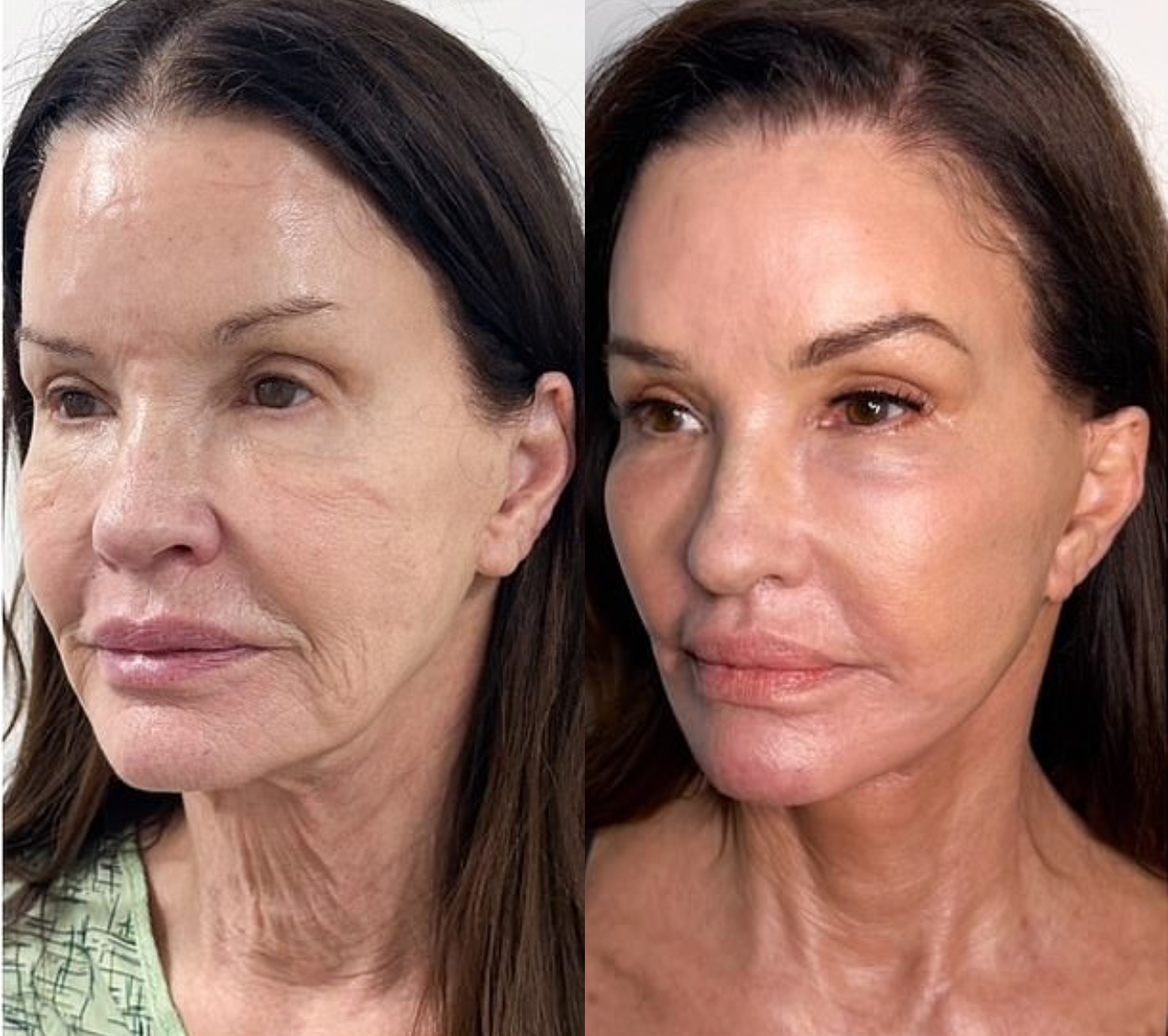 Từng tuyên bố mình là mẹ đẻ của từ 