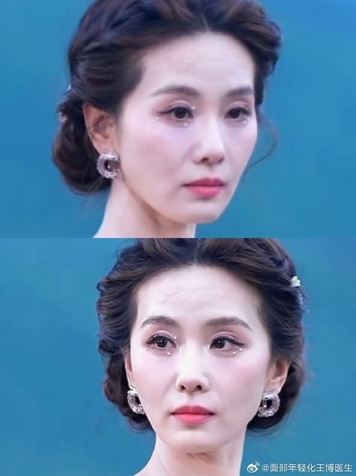 Qua cam thường của cánh truyền thông, gương mặt của Lưu Thi Thi lộ rõ sự mệt mỏi, mí sụp, hốc mắt sâu, ánh mắt vô hồn lờ đờ. Ảnh: Sina.