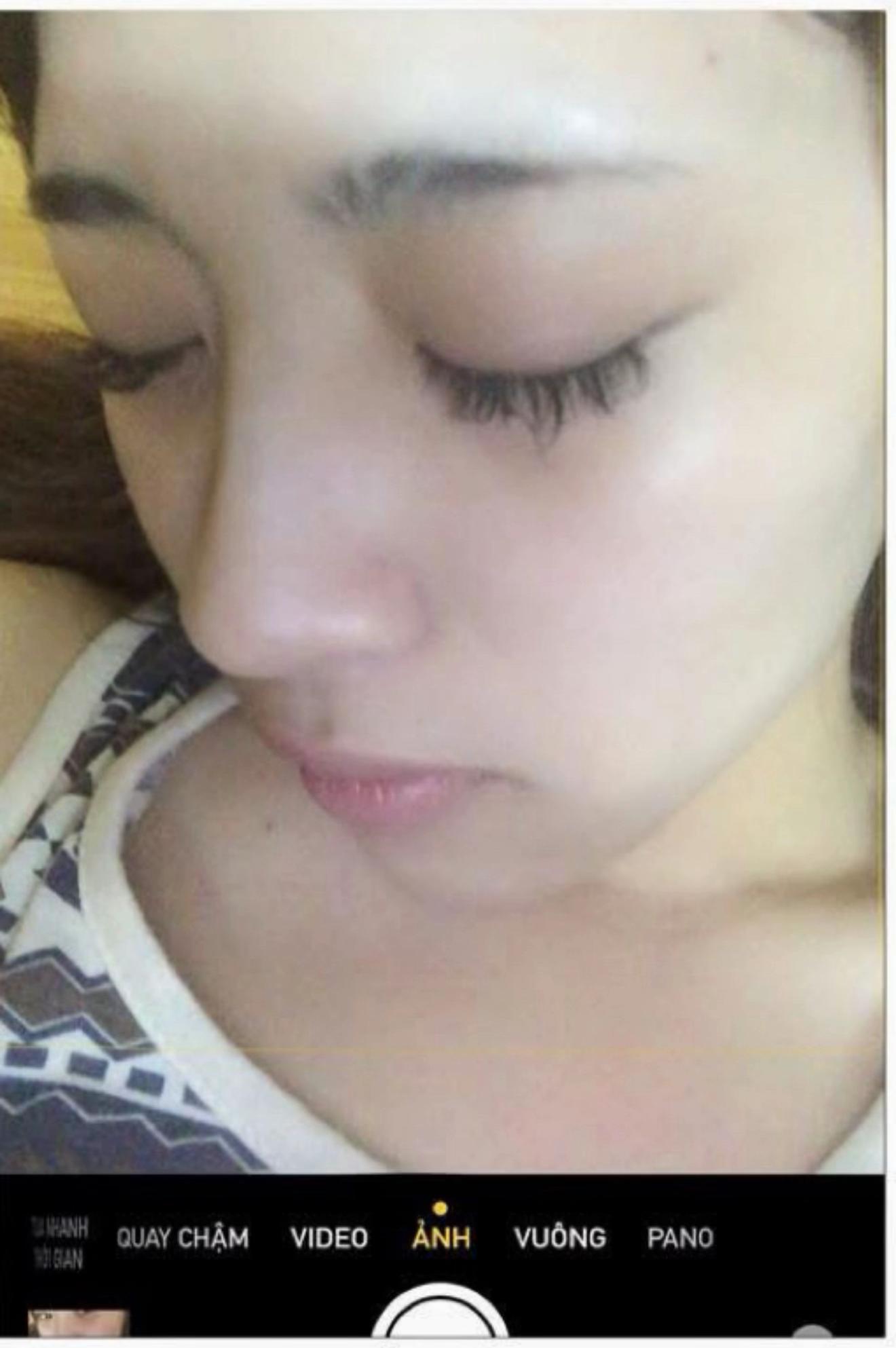 Trần Bích Hạnh - vợ Văn Thanh tháo sụn mũi, đăng luôn nhan sắc “nguyên thuỷ” đáp trả lời chê bai