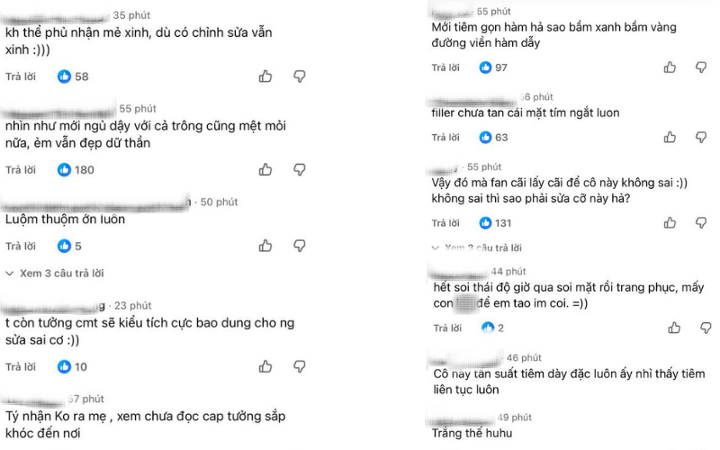 Không ít cộng đồng mạng cho rằng dấu hiệu bầm tím trên gương mặt của Jang Wonyoung là do thẩm mỹ.