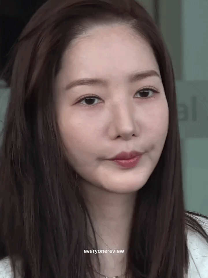 Park Min Young đã làm gì với gương mặt của mình vậy?