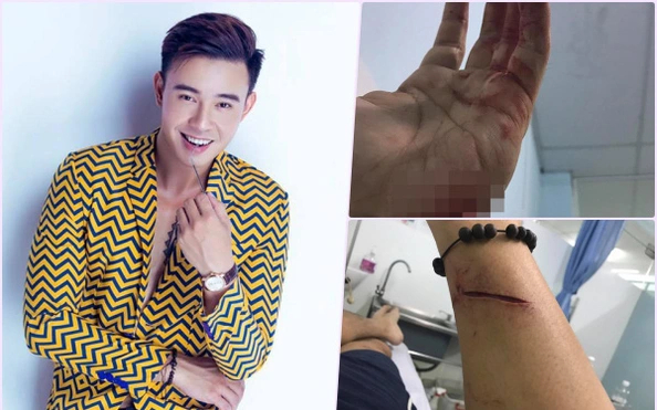 Vết thương của Đông Hùng từng khiến nhiều người không khỏi xót xa