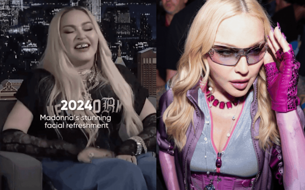 Madonna bây giờ khiến người ta suýt quên khuôn mặt từng biến dạng