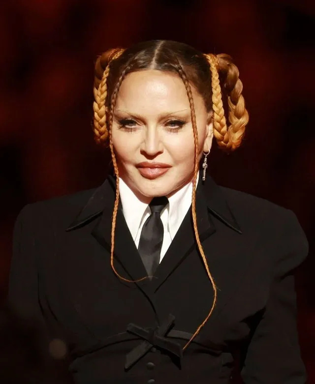 Madonna từng xuất hiện với khuôn mặt căng tròn khiến khán giả cho rằng phải lạm dụng chất làm đầy để da mặt luôn căng bóng. (Nguồn: Internet)