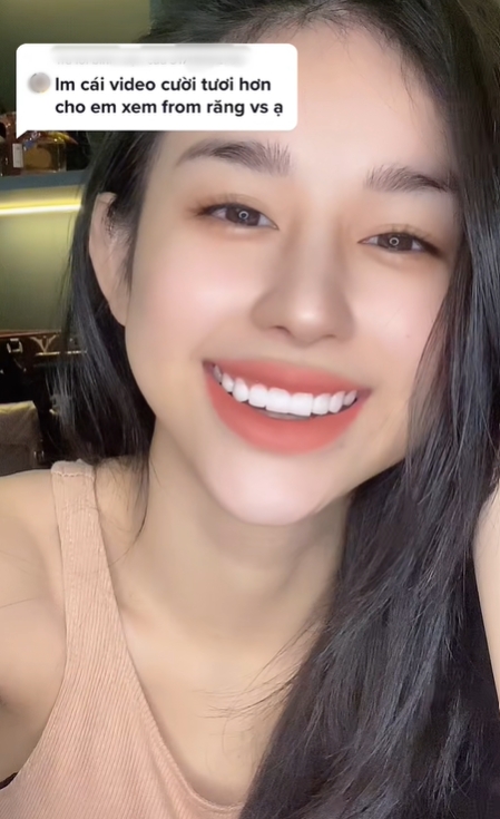 Cô nàng cũng làm răng và chỉnh dáng lông mày để hoàn thiện hơn về nhan sắc.