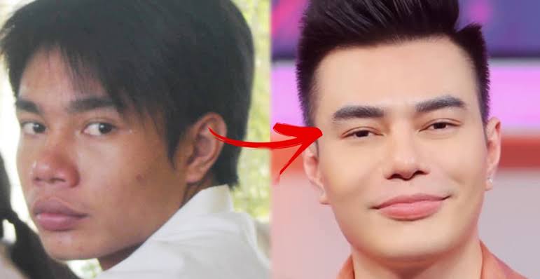 Người duy nhất khiến Trấn Thành phải nín nhịn: Trộm vàng sửa mũi để đổi vận, lập kỷ lục cả Vbiz không ai muốn phá