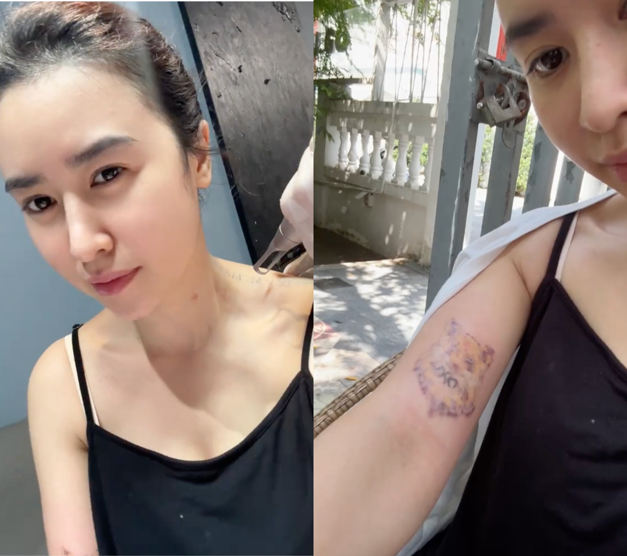 Hai hình xăm mà Quyên Qui đang kiên trì xoá bỏ.