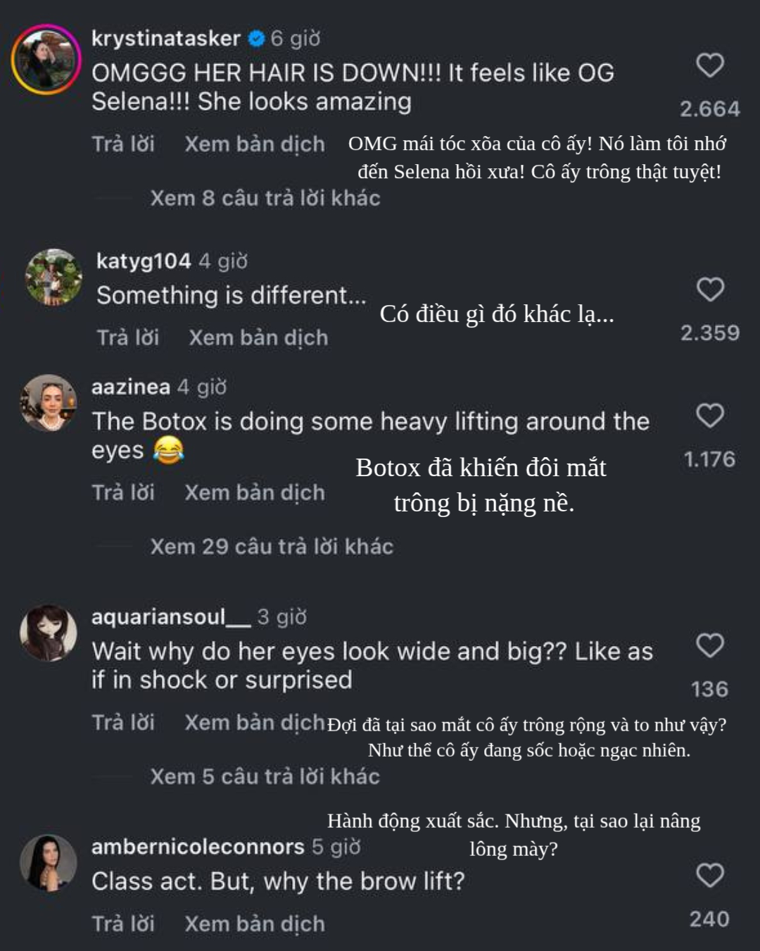 Netizen bàn tán về sự thay đổi trên gương mặt của Selena.