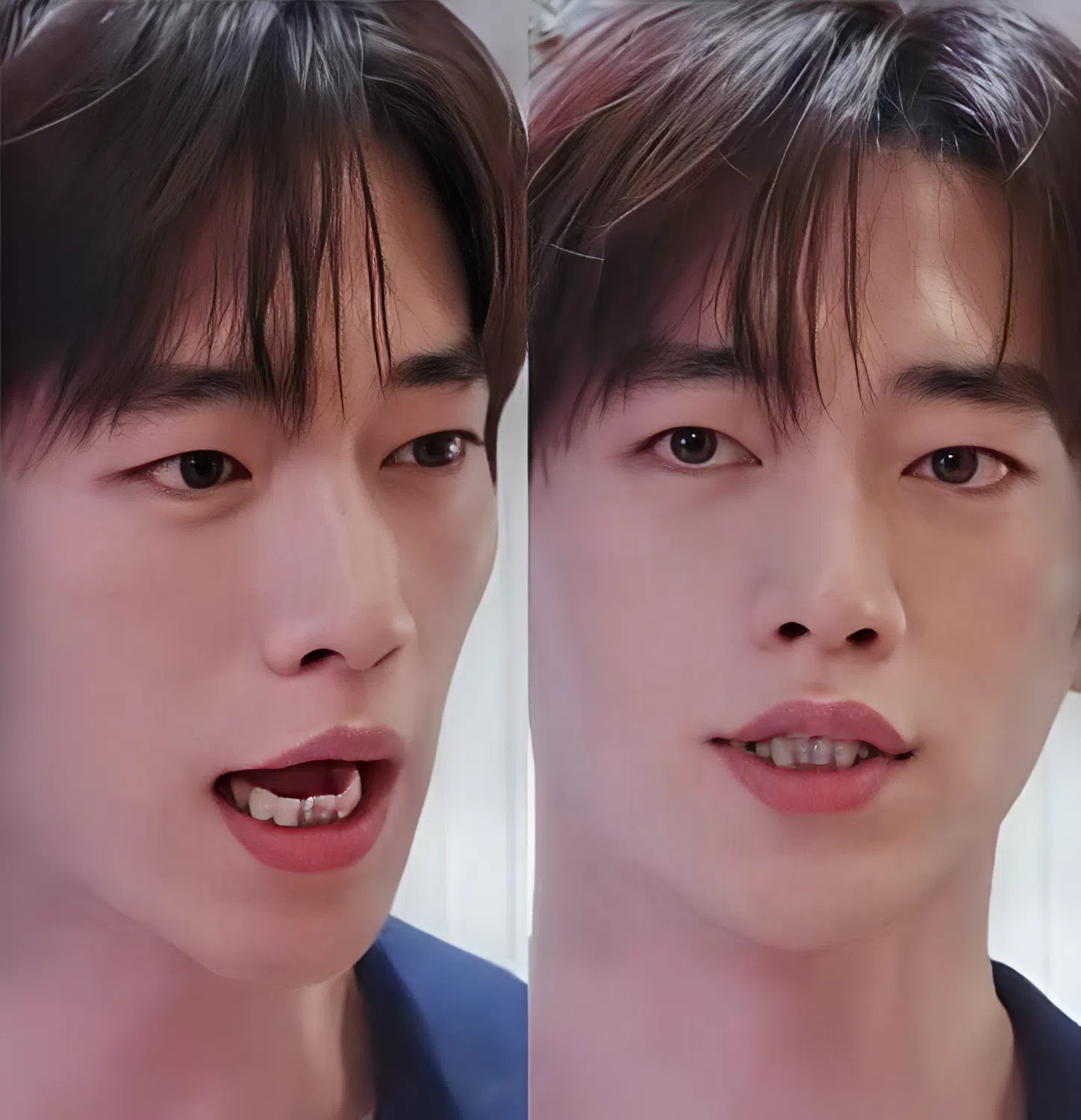 Hàm răng dưới kém thẩm mỹ của Seo Kang Joon trở thành chủ đề bàn luận trên các diễn đàn Hàn Quốc.
