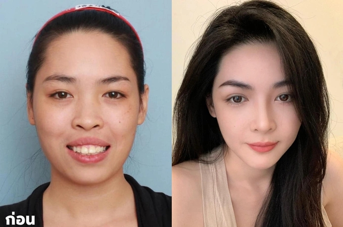 Màn lột xác ấn tượng của Vũ Thanh Quỳnh vào năm 2015.