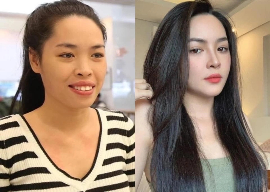 Người đẹp từng lột xác thành công nhờ 