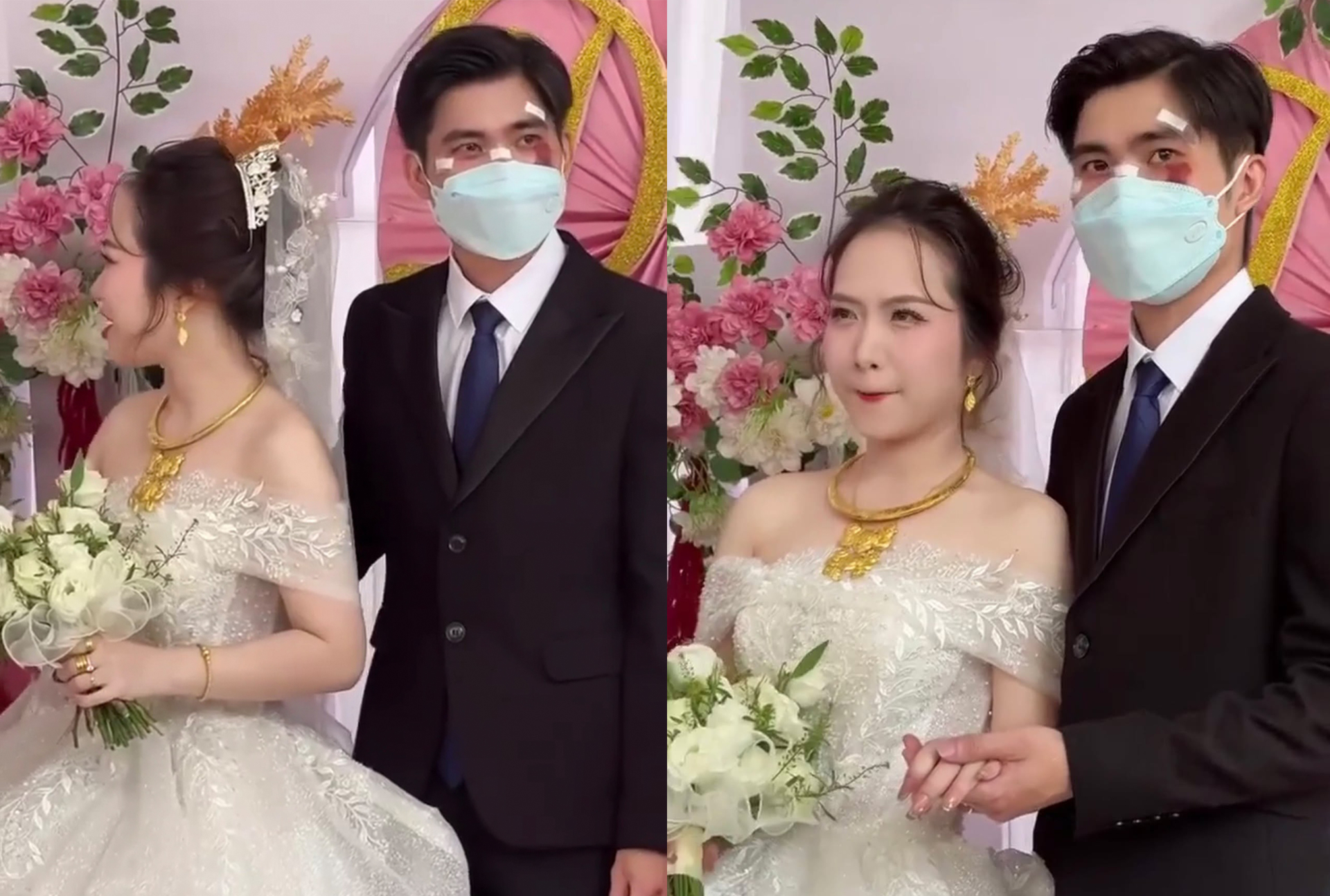 Dũng phải đeo khẩu trang trong ngày cưới để che vết thương trên mặt.