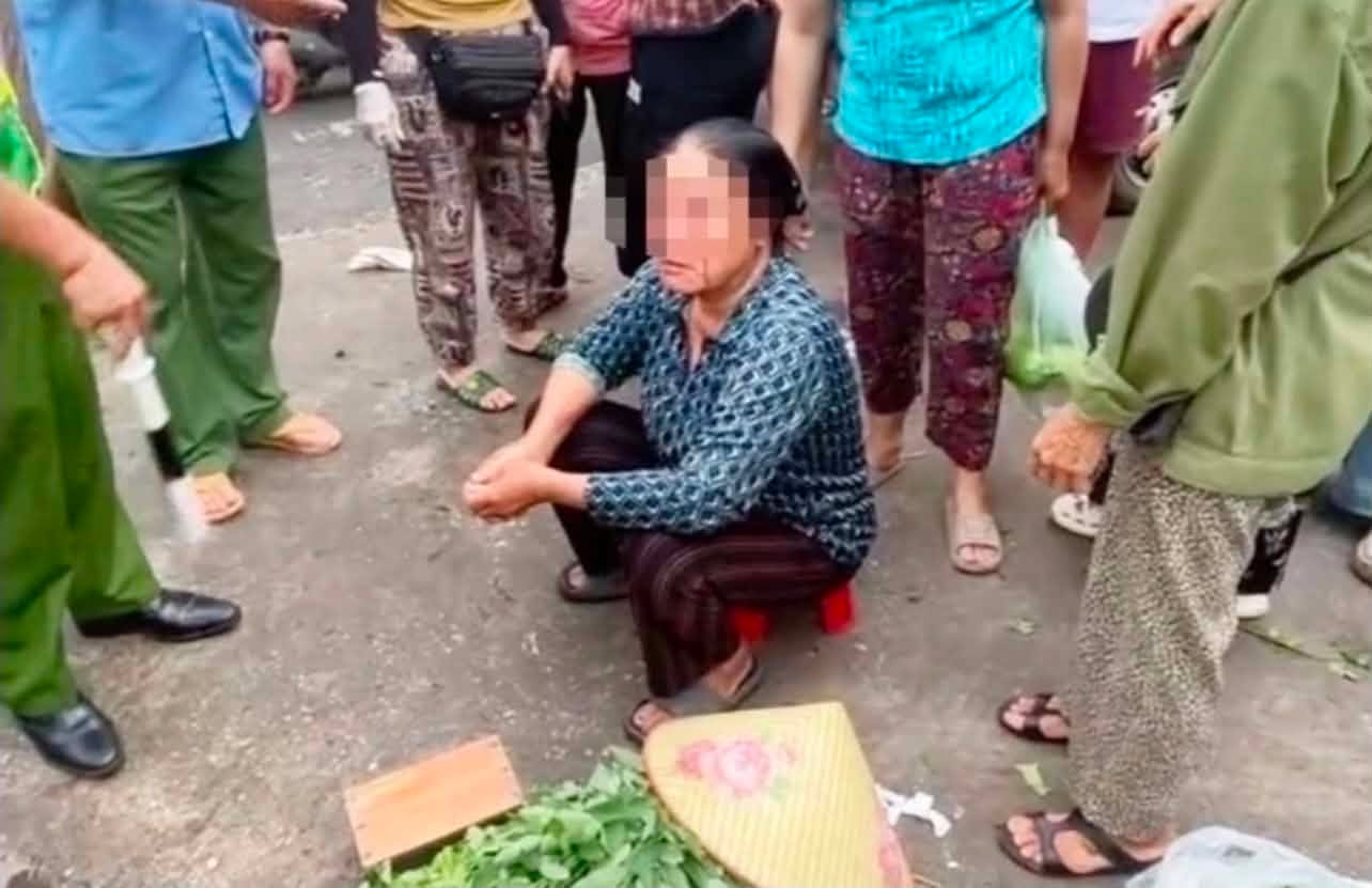 Bà Q. bị chảy máu mắt.