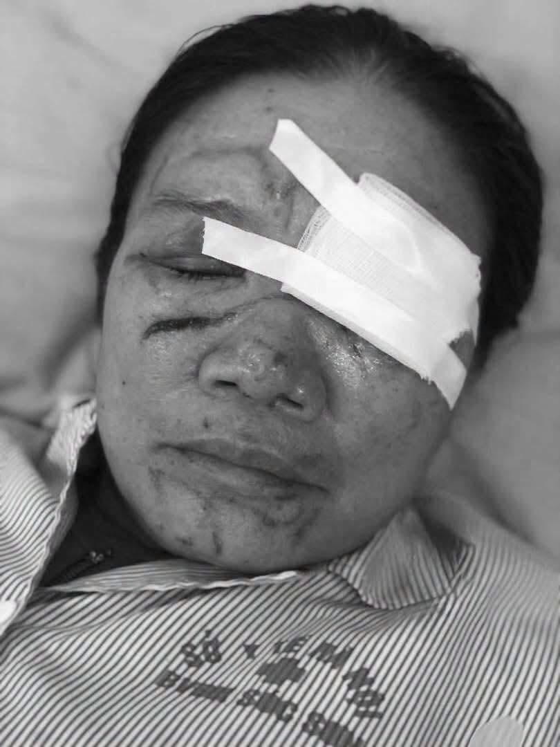Bà Q. đang điều trị tại Bệnh viện Đa khoa Sóc Sơn.
