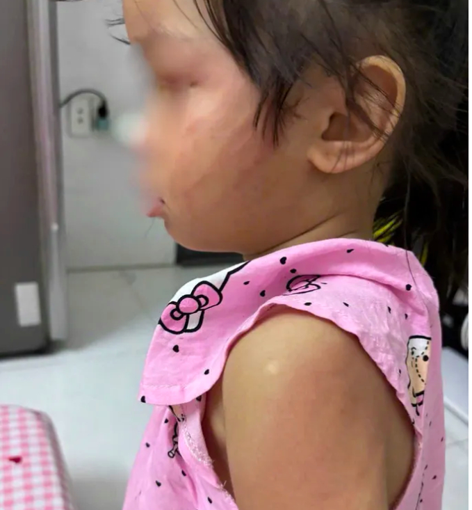 Cháu bé bị cha dượng bạo hành. (Nguồn ảnh: SGGP)