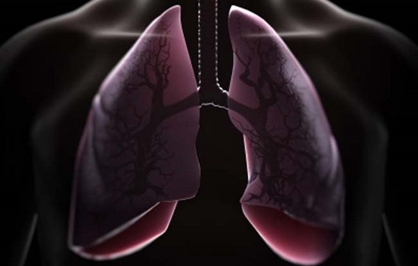 Ô nhiễm không khí gây các bệnh về phổi và tim. Ảnh minh họa: Internet.