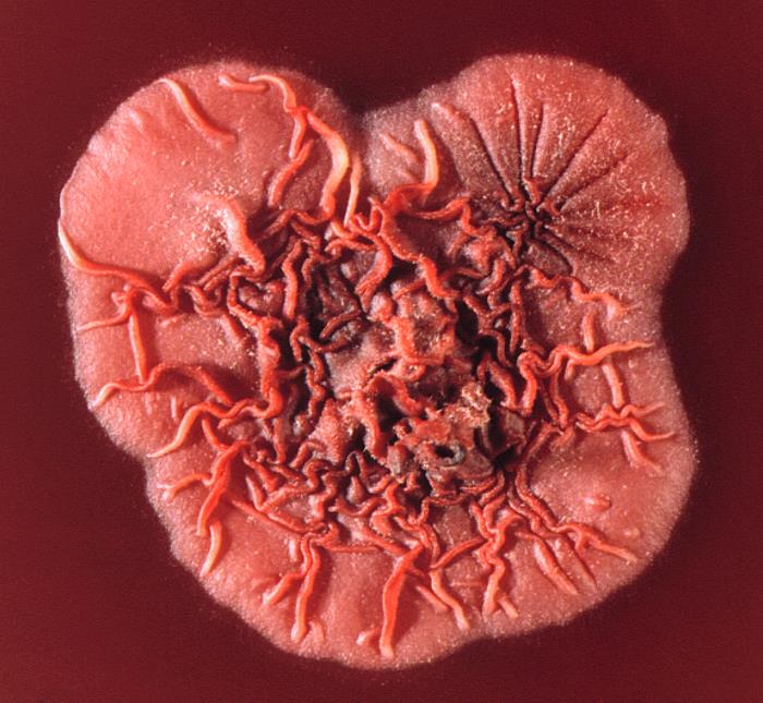 Khuẩn lạc Talaromyces marneffei được nuôi trên đĩa Petri. Nguồn: CDC/James D. Gathany.