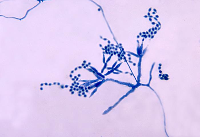 Ảnh hiển vi cho thấy chuỗi bào tử hình giọt nước của Talaromyces marneffei. Nguồn: CDC/Dr. Libero Ajello.