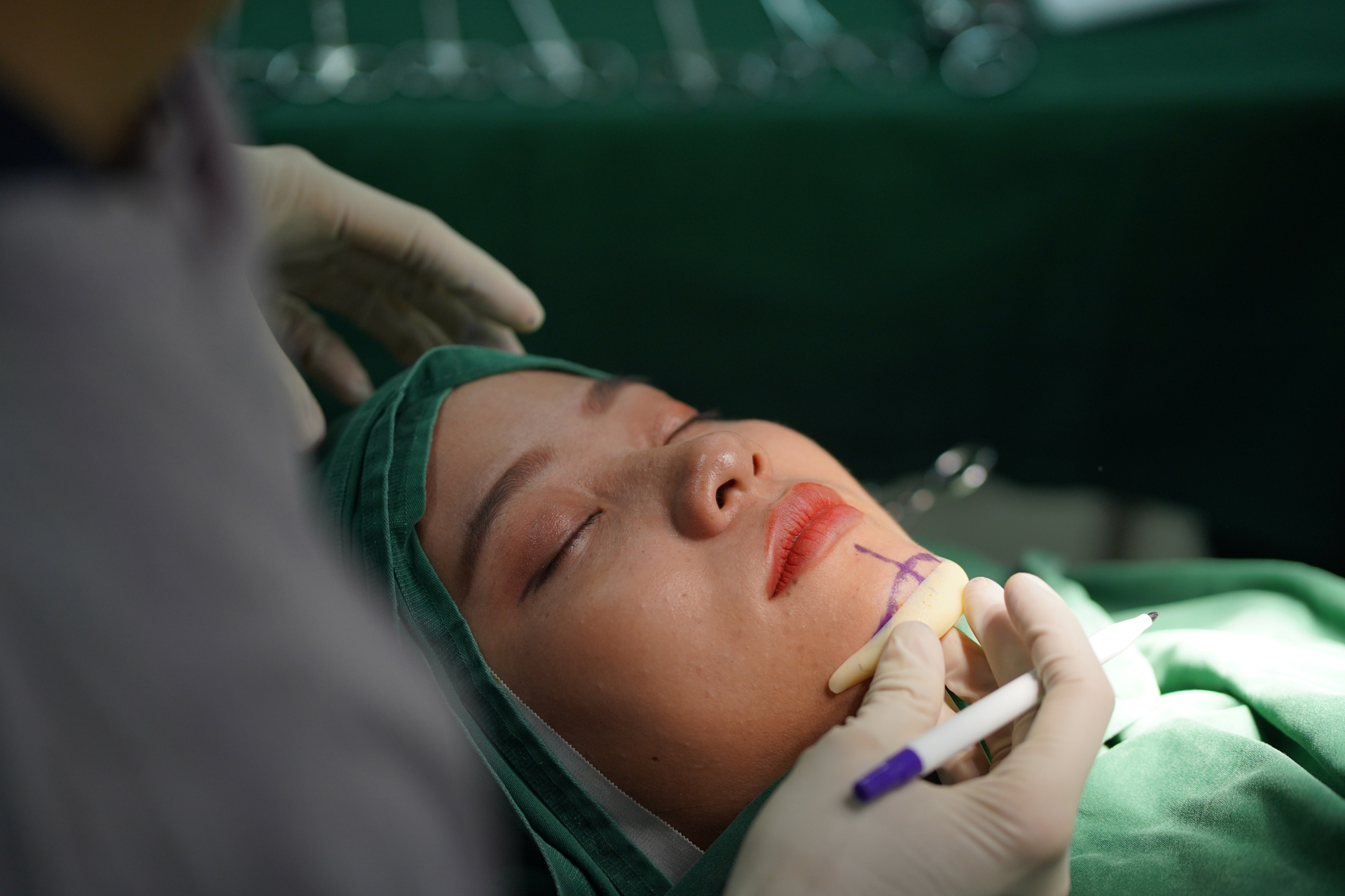 Phương pháp độn cằm có chi phí dao động từ 25 - 45 triệu đồng
