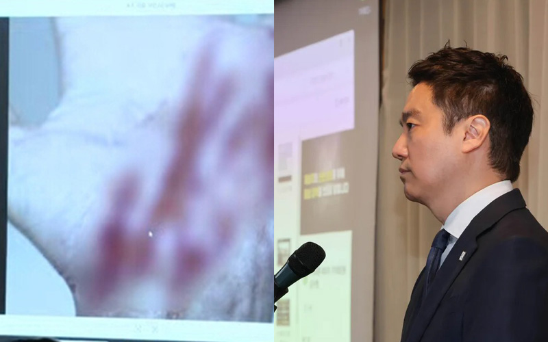 Viện G công bố hình ảnh vết thương của người nắm giữ ghi âm Kim Sae Ron thừa nhận 