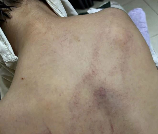 Những vết thương của đứa trẻ khiến tôi bàng hoàng, đau xót