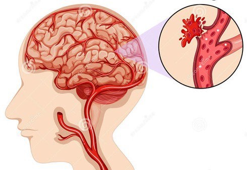 Nữ ca sĩ chia sẻ cơn ác mộng mang tên 