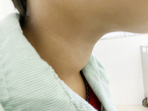 Bé trai 10 tuổi bị cường giáp chuyển suy giáp chỉ sau vài tháng: Nguyên nhân cha mẹ không thể ngờ - Ảnh 3. Bé trai 10 tuổi bị cường giáp chuyển suy giáp chỉ sau vài tháng: Nguyên nhân cha mẹ không thể ngờ - Ảnh 3.