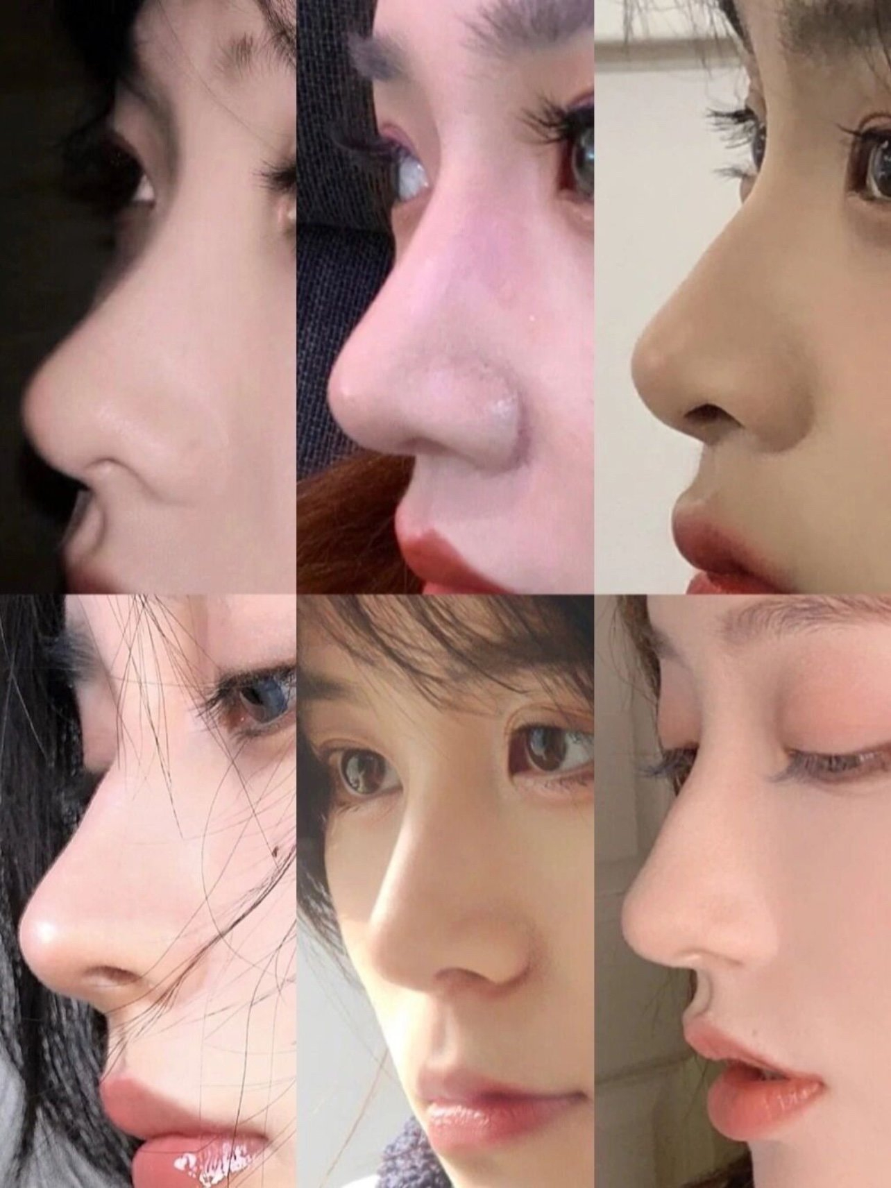 Những chiếc mũi 