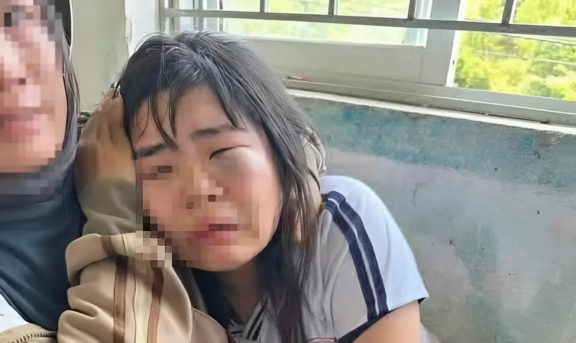 Nạn nhân bị đánh sưng húp mặt, mắt bầm tím
