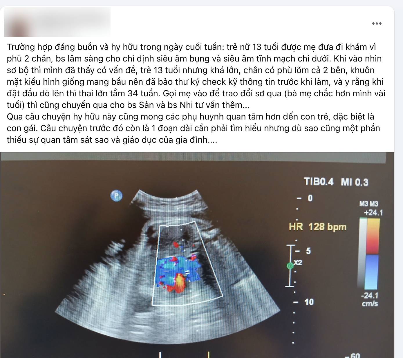 Bài đăng thu hút sự chú ý