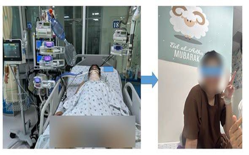 Sau gần hai tháng điều trị, các bác sĩ cho biết em đã tỉnh táo, tri giác cải thiện tốt, tự thở được và hầu như không để lại di chứng.