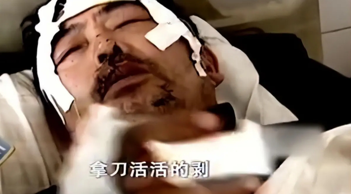 Ông Chu may mắn sống sót nhưng bị thương nghiêm trọng