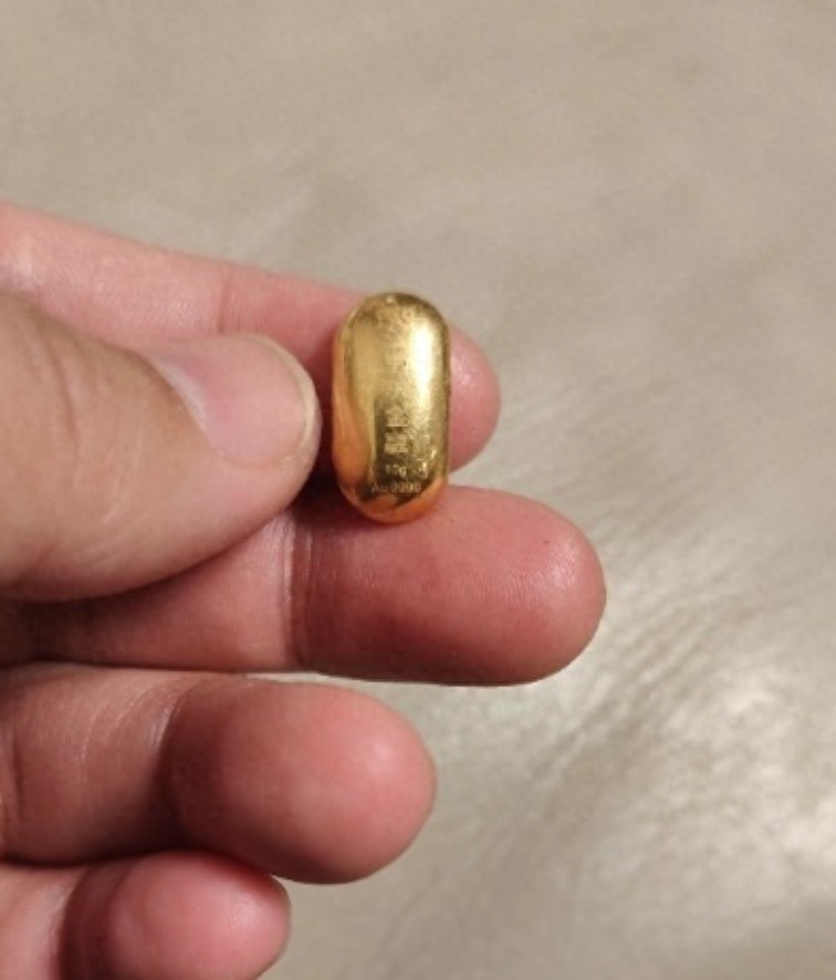 Miếng vàng cậu bé đã nuốt nhầm