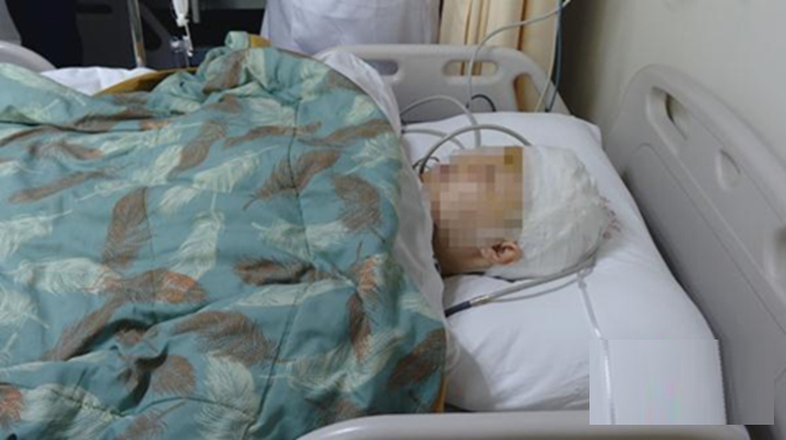 Người phụ nữ 55 tuổi viêm màng não sau khi ăn loại thịt nhà nào cũng có trong tủ lạnh