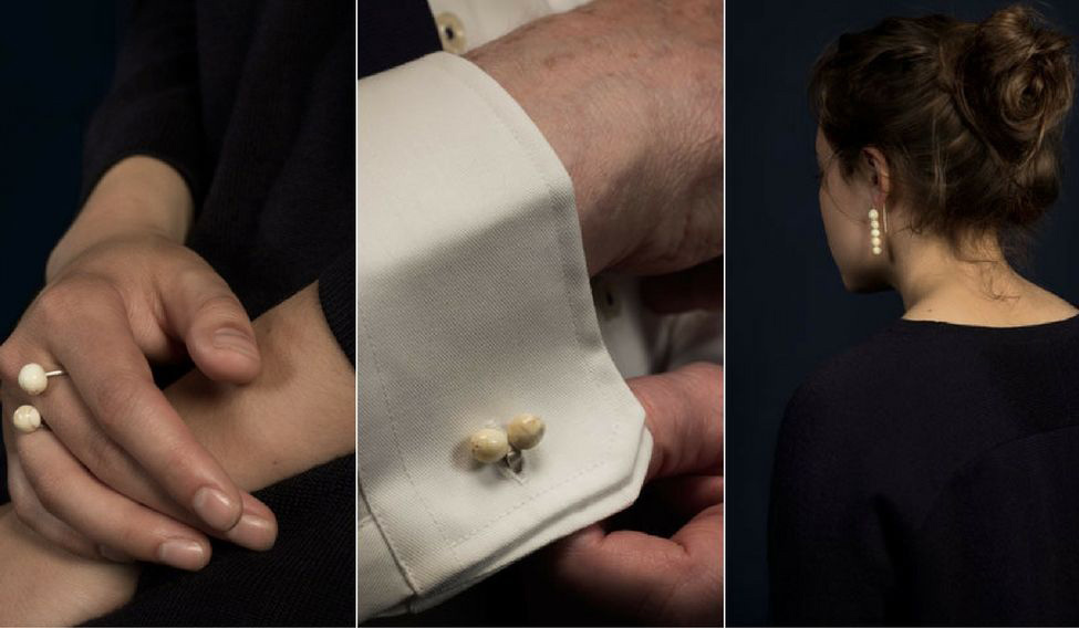 Cô gái chuyên thu mua răng người