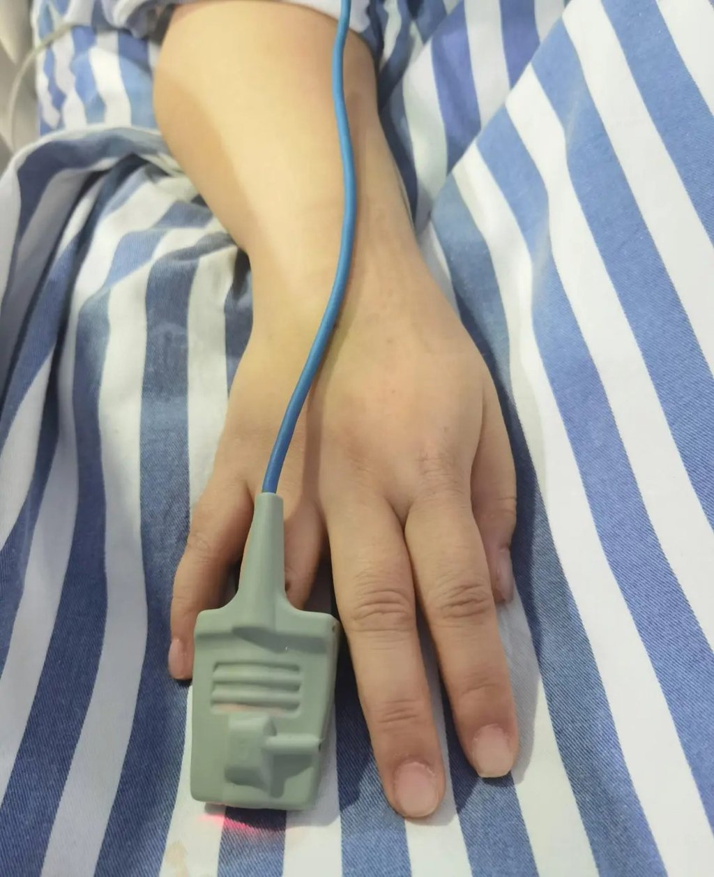 Cô gái nguy kịch khi nhập viện cấp cứu nhưng không thể lắp máy hỗ trợ vì bộ móng úp