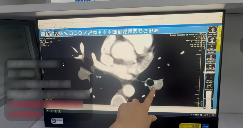 Đạp xe 47km để tạo