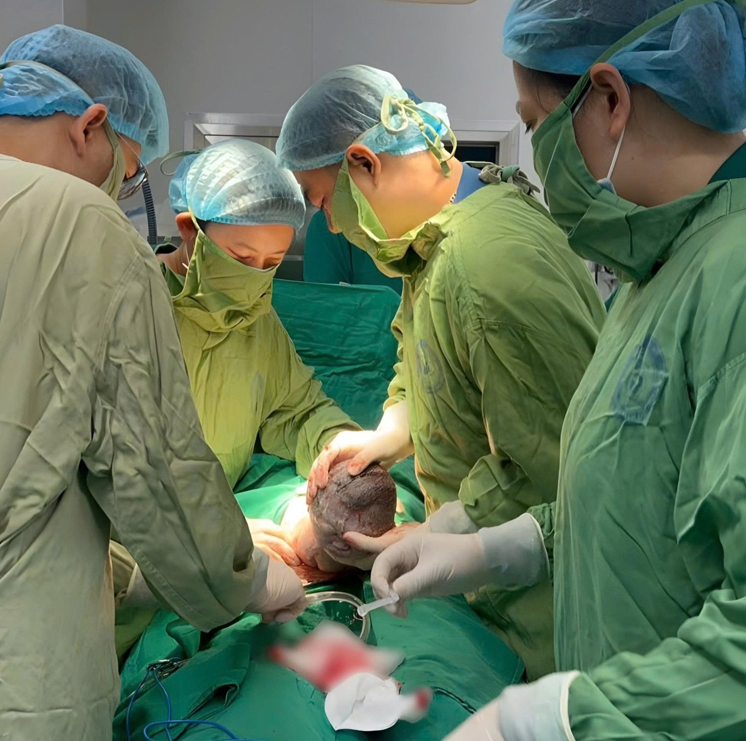   Em bé ra đời sau ca mổ lấy thai nặng 3,4kg   