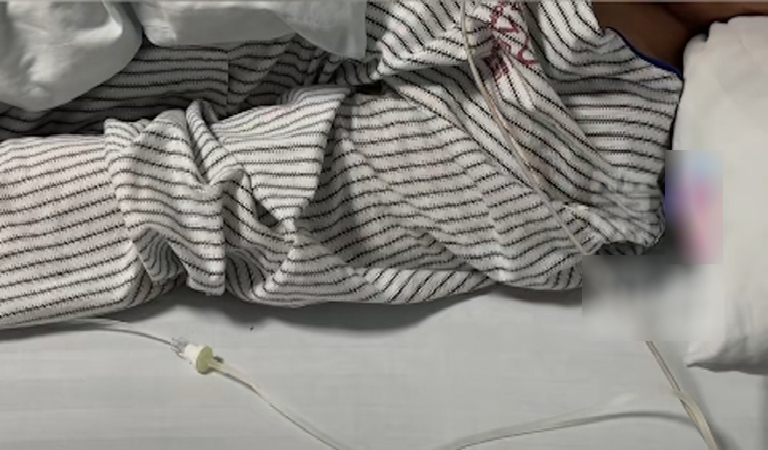 Chàng trai 30 tuổi mắt phải bỗng bị mờ, đi khám bác sĩ kết luận: Hệ miễn dịch đã bị tổn hại hoàn toàn