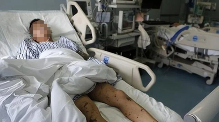 Người đàn ông suy thận vì mắc 1 sai lầm khi làm