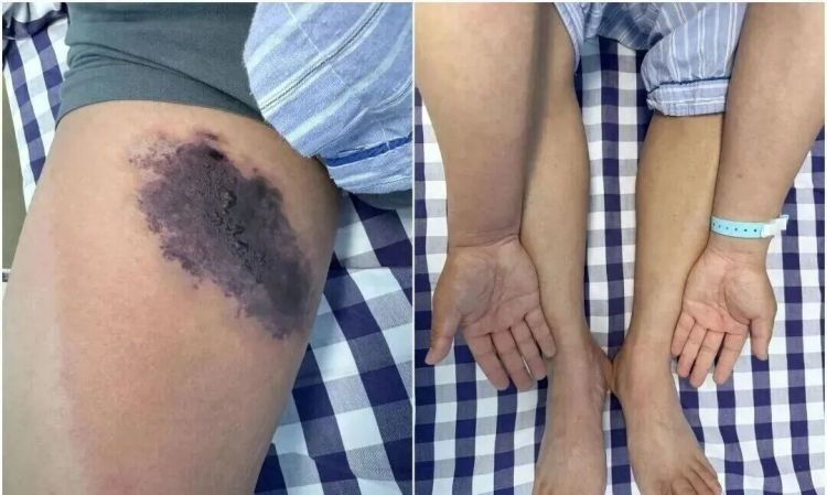 Mặc chiếc quần cũ, người đàn ông suýt