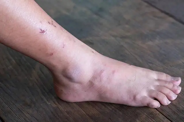 Khi ung thư mới bắt đầu hình thành, người ta thường cảm thấy 3 điều không ổn, nhưng ít ai chú ý đến