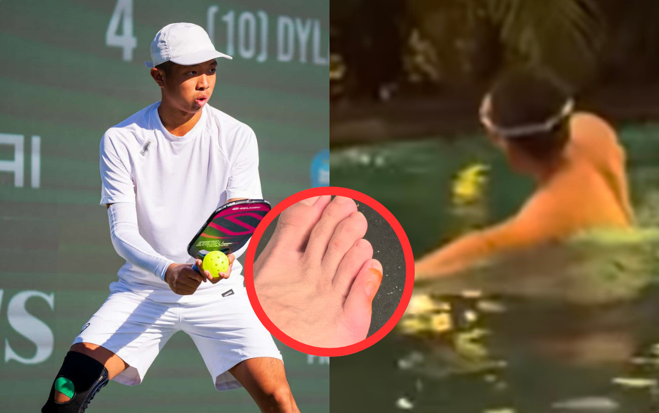 Quang Dương ngâm ngước 36 tiếng xử lý chân phồng rộp, bác sĩ thể thao lên tiếng