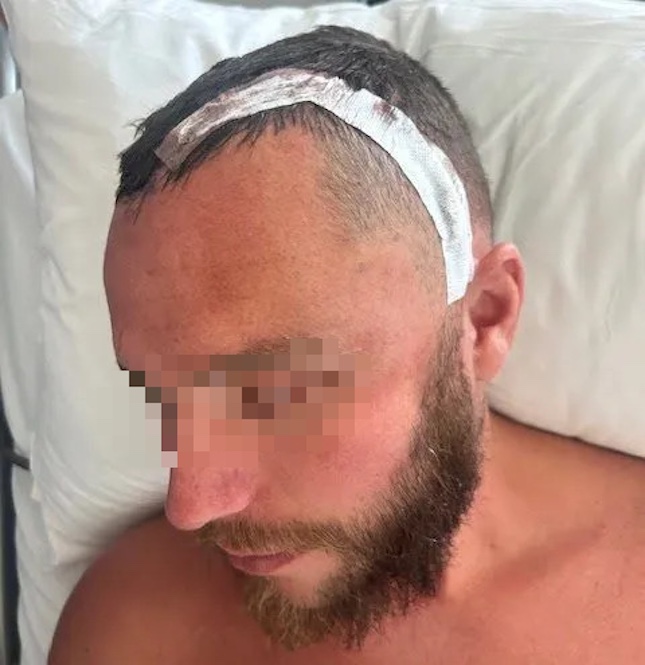 Dù phẫu thuật u não thành công, Lewis đối mặt với 1 loạt di chứng và đặc biệt là cơn đau bụng vẫn tiếp diễn mà không rõ nguyên do