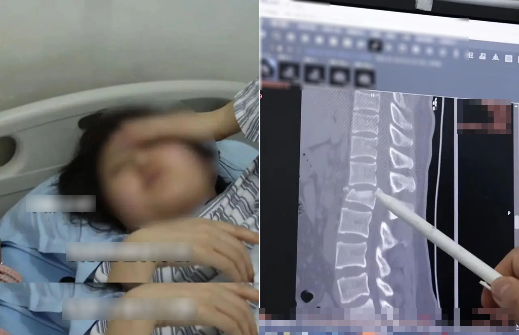 Dùng điện thoại khi làm 1 việc, cô gái có thể liệt 2 chân, tiểu không tự chủ suốt đời