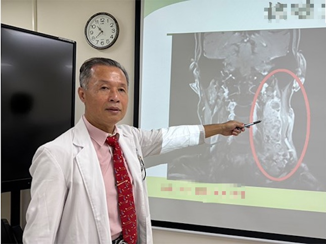 Bác sĩ Teng Cheng-Tsung cho biết, khối u của nam giám đốc này dài 12cm