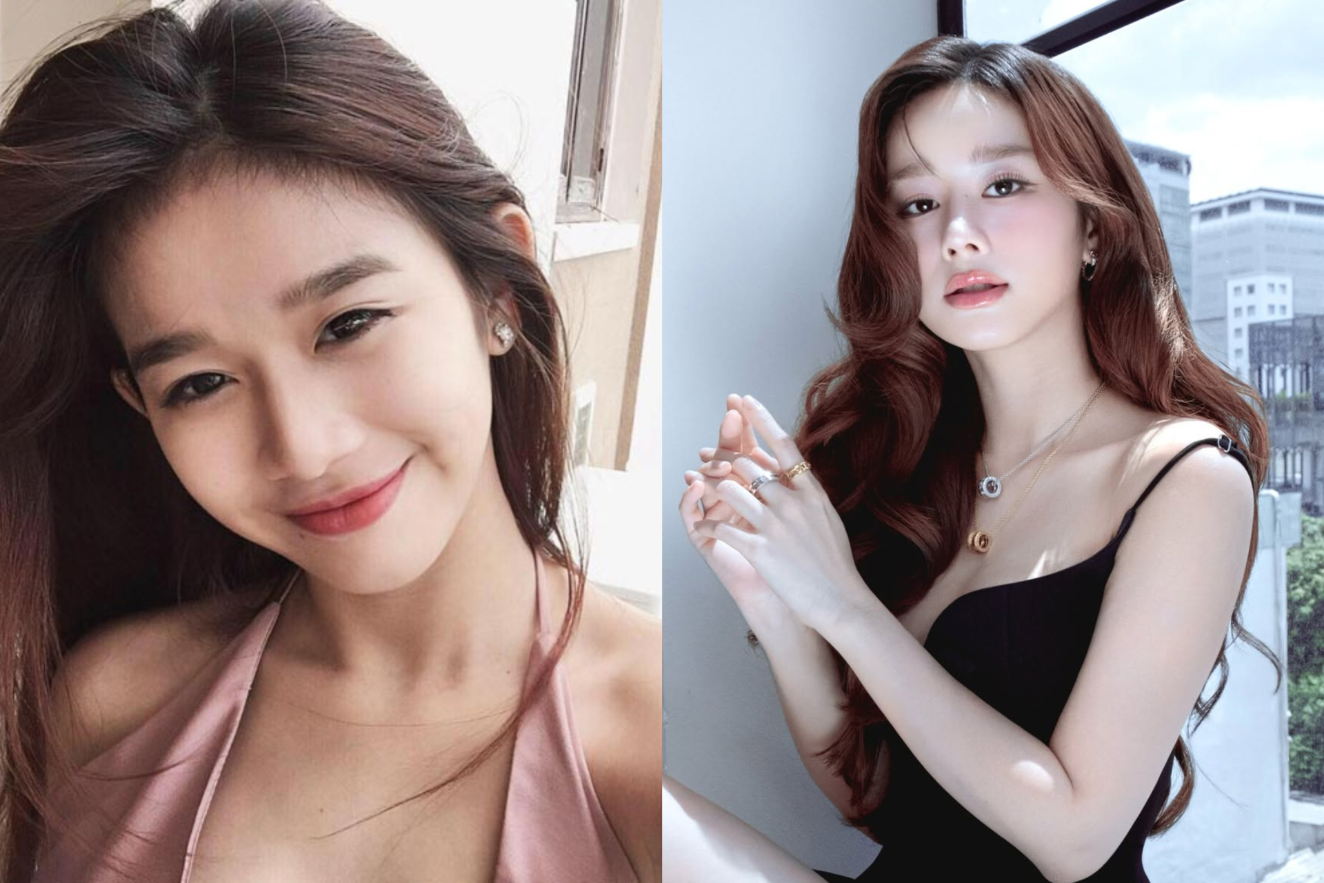 Diện mạo của nữ diễn viên trước và sau khi can thiệp